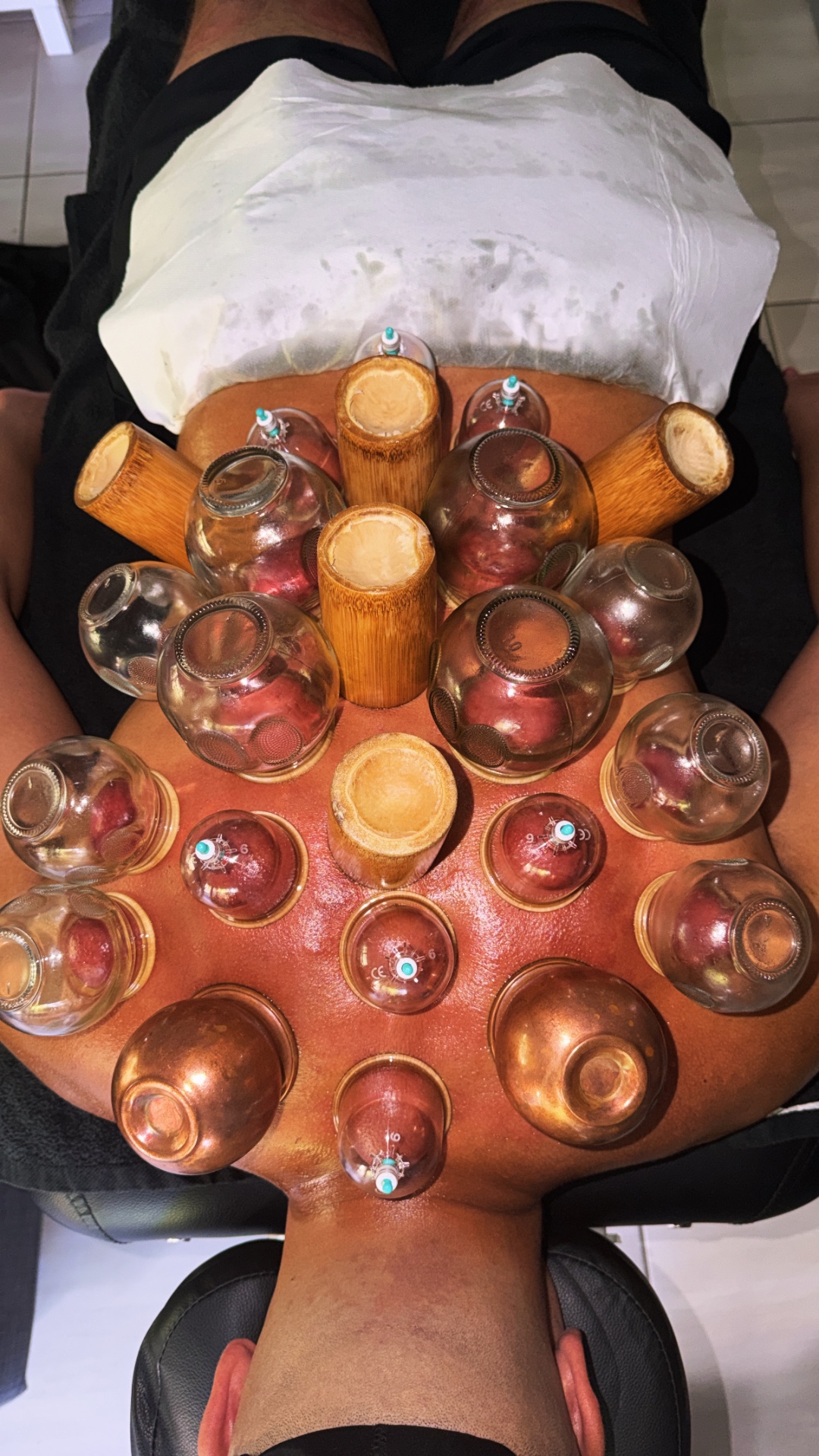 Cupping full body